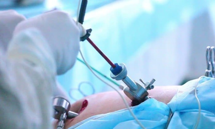 Pediatric Laparoscopic Surgery Main Image